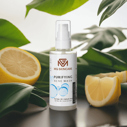 Purifyng Acne Wash - Walter - Mall